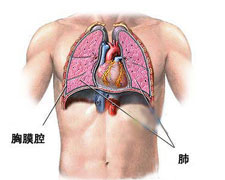 胸水患者必看：五种有效缓解胸闷的方法！