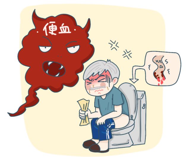 肝硬化腹水为什么会有便血？淋滞疏通丸